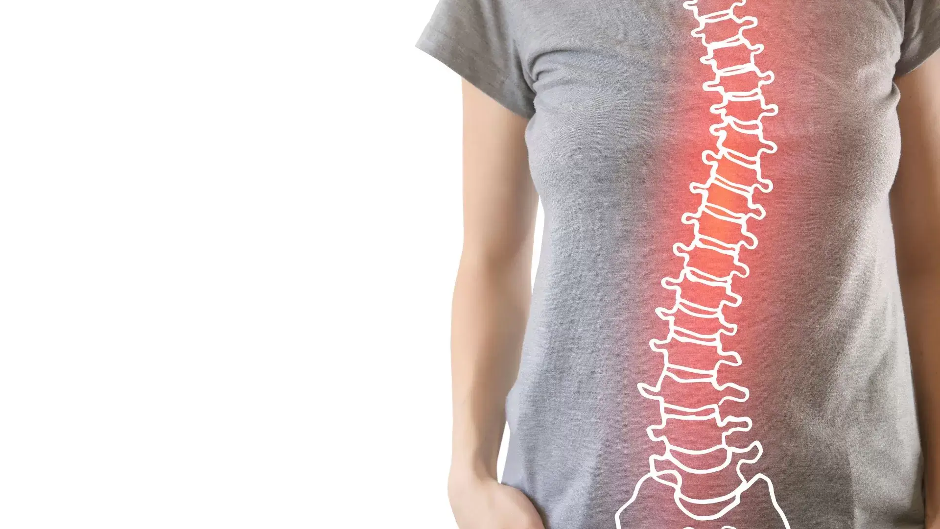 Signs and Symptoms of Scoliosis