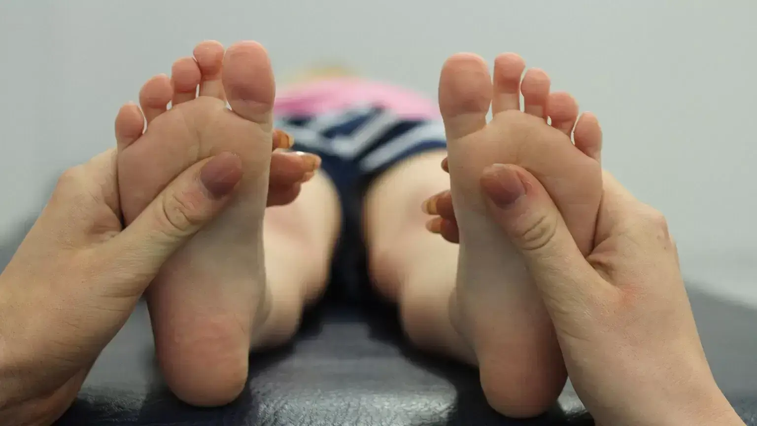 Managing Clubfoot Relapse with Physiotherapy